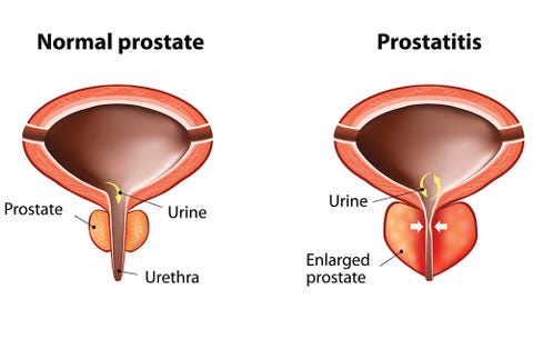 prostate