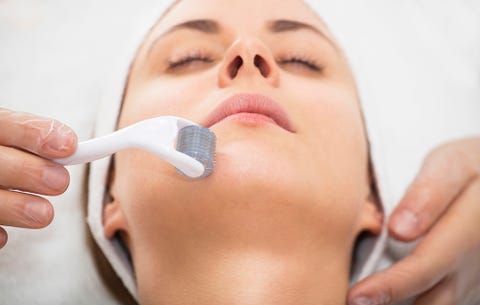 Microneedling/Dermaroller