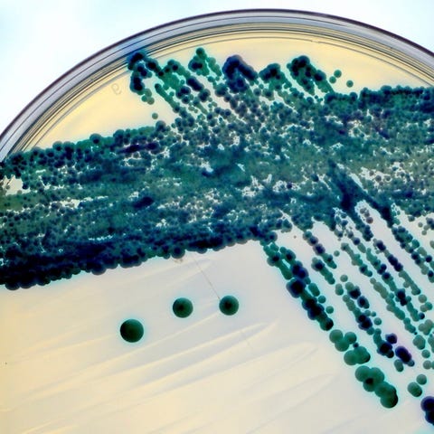 skin infections skin infections