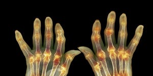 Why Do My Feet Hurt So Bad 11 Causes And How To Stop The Pain Why Do My Feet Hurt So Bad 11 Causes And How To Stop The Pain