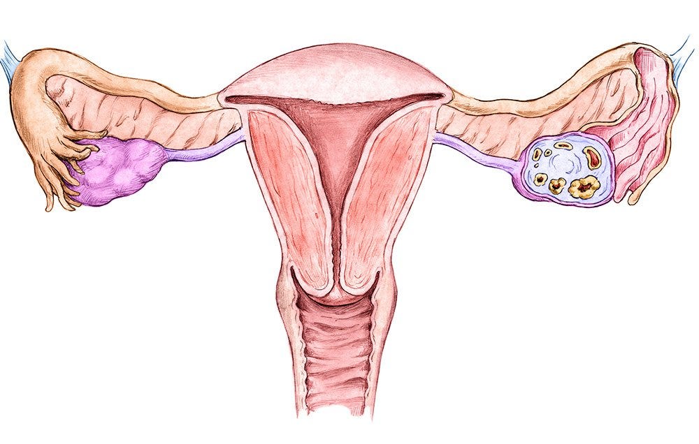 5 Warning Signs Of Endometrial Cancer Every Woman Should ...