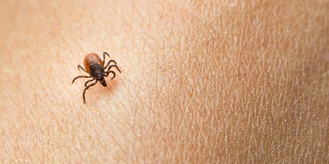 Lyme Disease Risk
