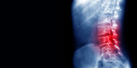 5 Signs Your Back Pain Might Signal A More Serious Problem Prevention 5 Signs Your Back Pain Might Signal A More Serious Problem Prevention