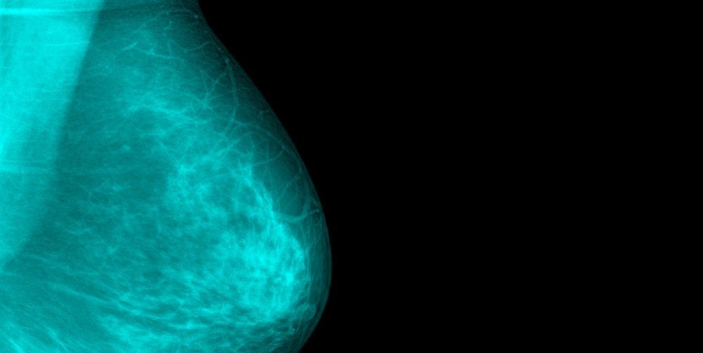 6 Early Warning Signs Of Breast Cancer Besides A Lump