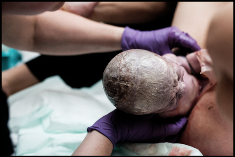 Kænguru Undskyld mig Erobrer Empowered Birth Project Fights Childbirth Photos Being Censored on Instagram