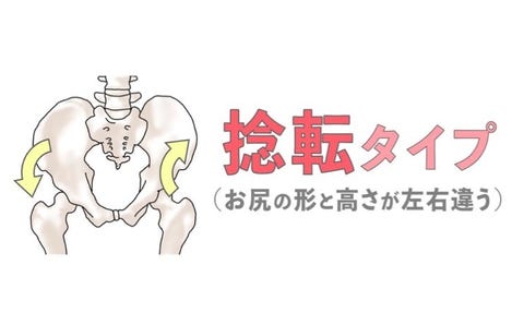 解説 骨盤のゆがみをチェックする方法と簡単にできる骨盤矯正ストレッチ 解説 骨盤のゆがみをチェックする方法と簡単にできる骨盤矯正ストレッチ