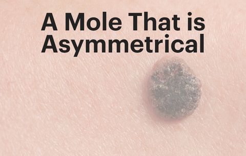 Mole penis raised on Genital skin