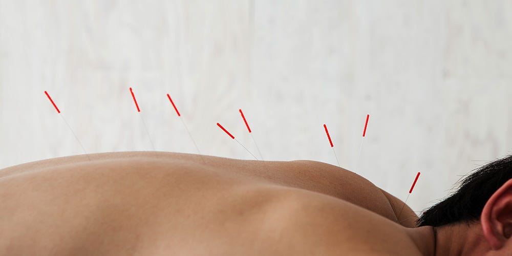 Acupuncture For Weight Loss Does It Work Men S Health Acupuncture For Weight Loss Does It Work Men S Health