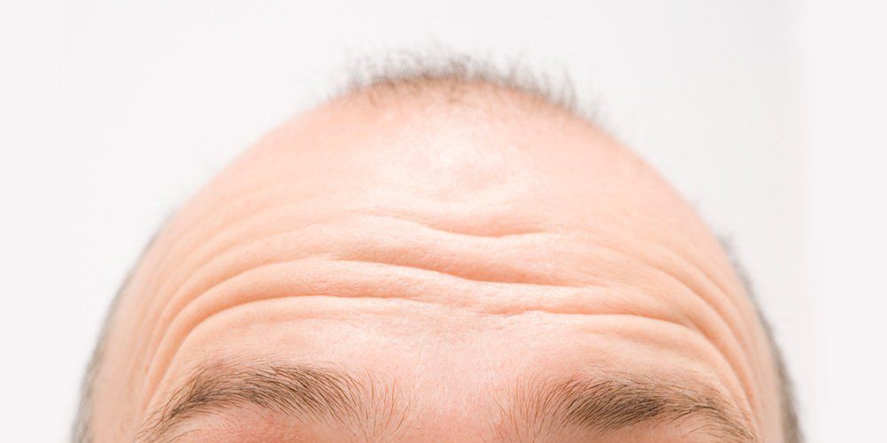 Tinder bald guys on Guy Photoshops