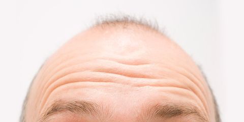 baldness myths
