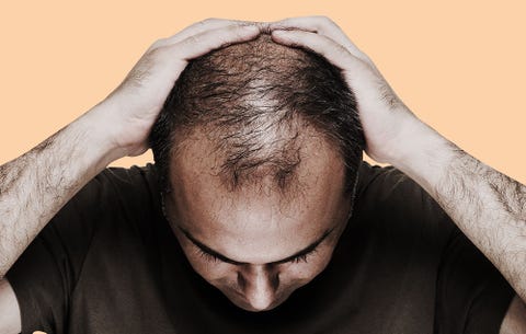 New Discovery May End Balding And Graying Hair Men S Health