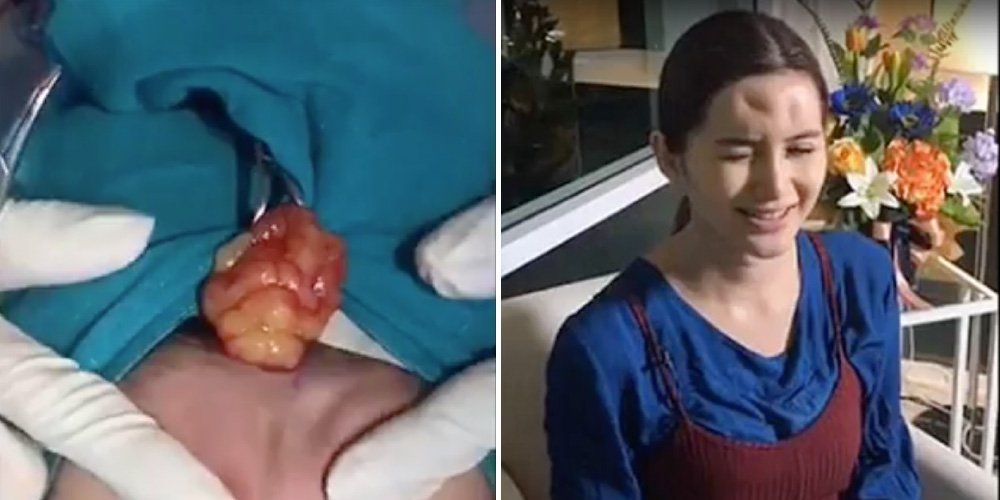 This Disgusting Pus Popping Video Will Make You Gag Men S Health
