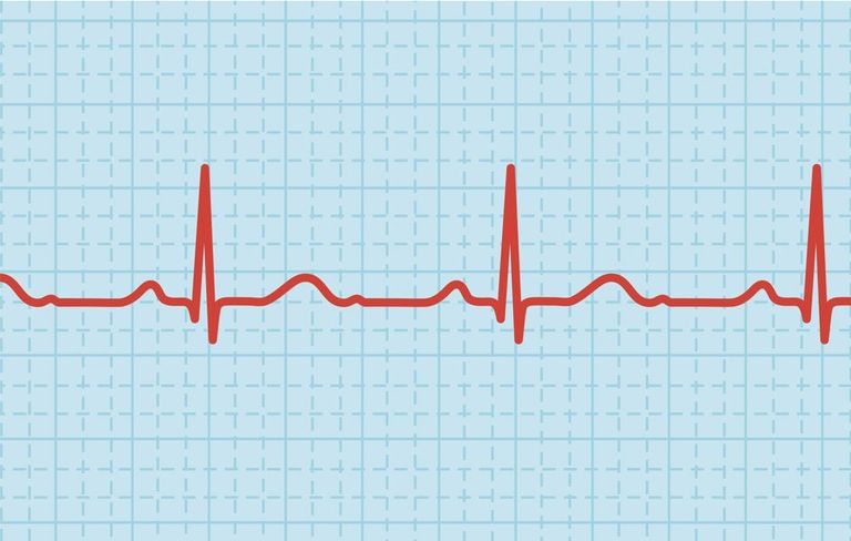 Lower Your Heart Rate to Prevent a Heart Attack | Men's Health