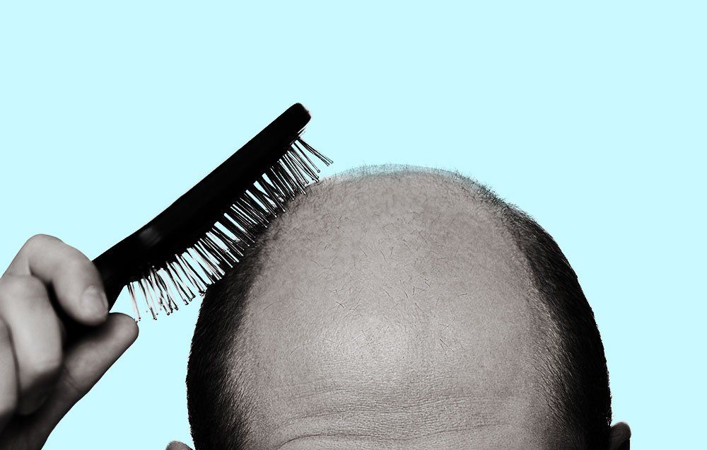 What Men Should Do When Hair Loss Starts​ | Men's Health