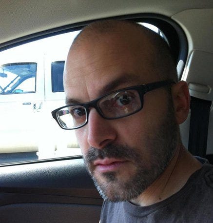 If You Re Balding Should You Shave Your Head