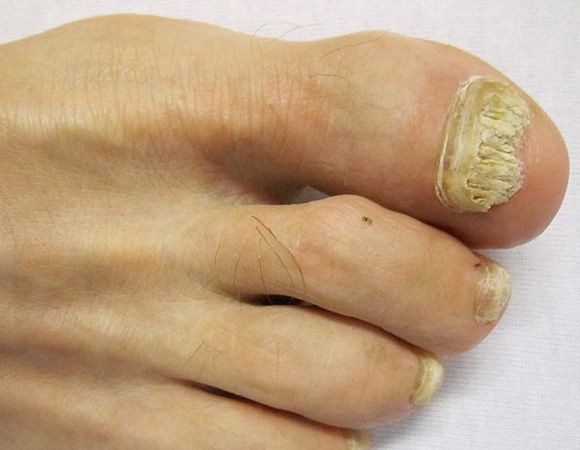 What Your Nails Say About Your Health What Your Nails Say About Your Health