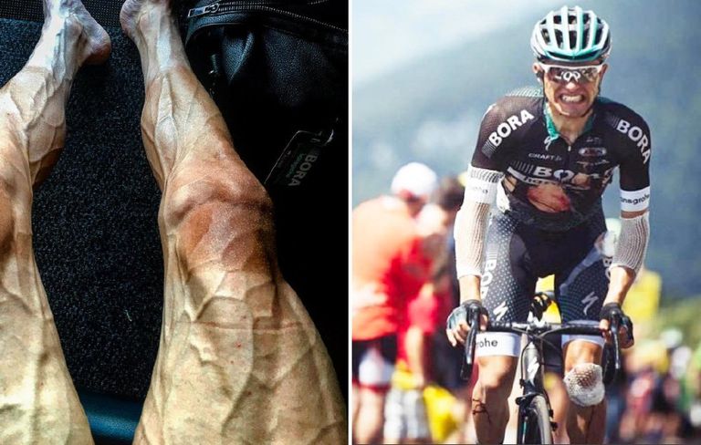 This Photo of a Tour de France Rider's Legs After Stage 16 is Unbelievable | Men's Health