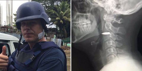 man close to death bullet in neck