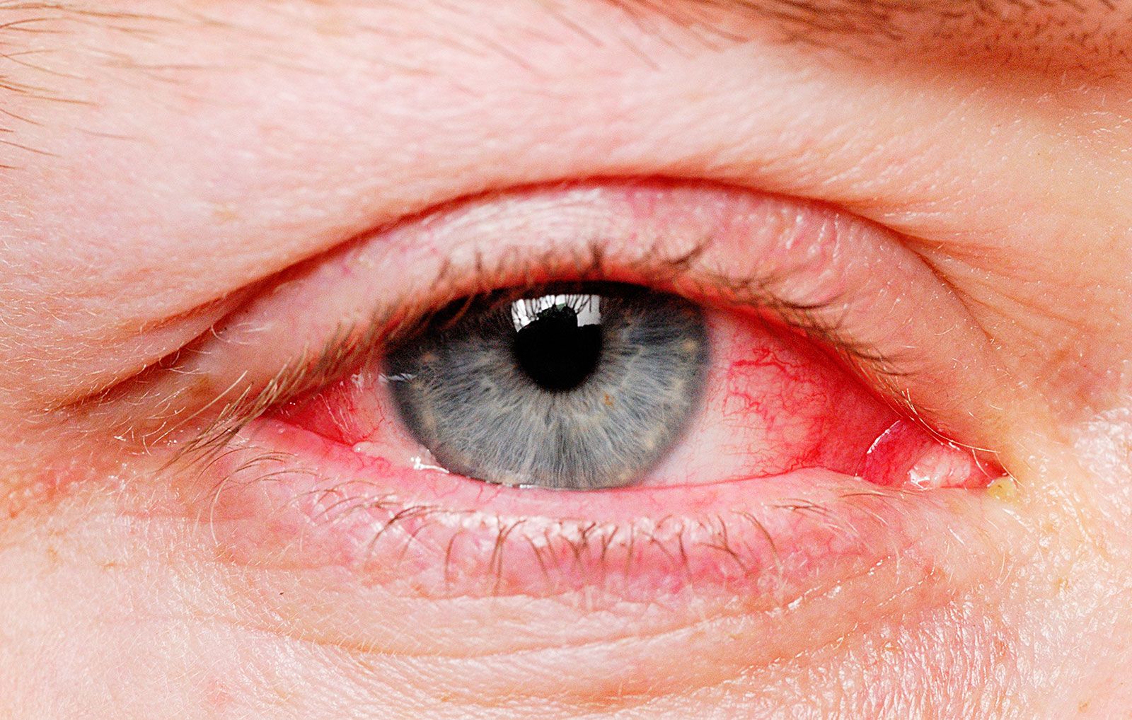 Bloodshot Eyes How To Reduce Eye Redness Men S Health