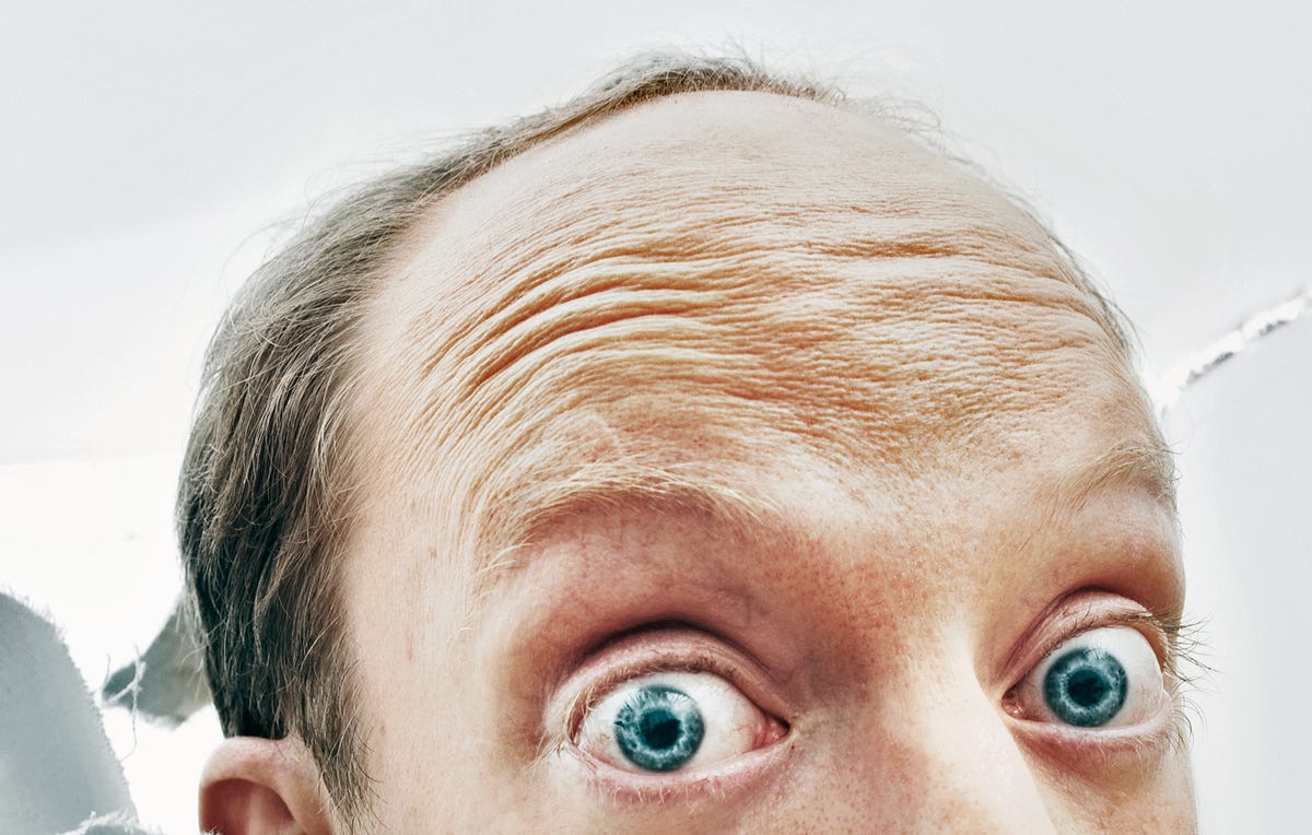 Early Balding and Gray Hair Linked to Heart Disease | Men’s Health