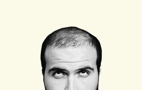 Rogaine Thief Goes To Extreme Lengths To Prevent Balding Men S
