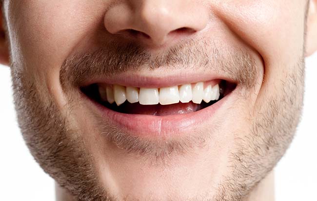 Top 10 over counter teeth whiteners