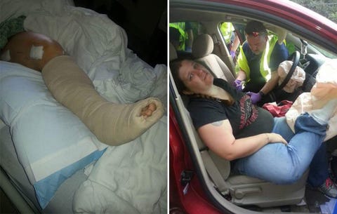 Woman Suffers Gruesome Accident Because of This Common Car Habit | Men