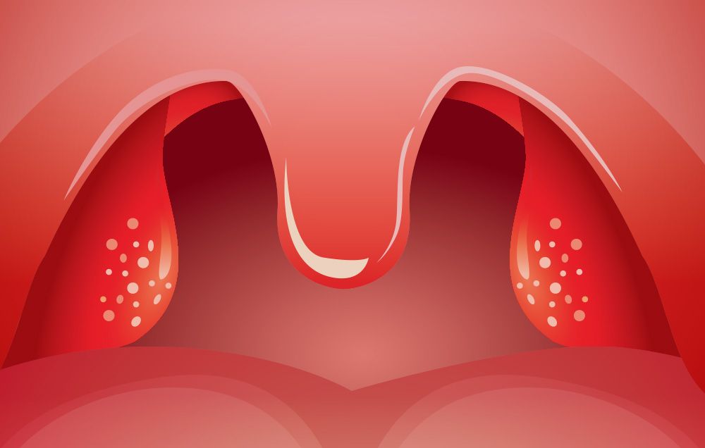 enlarged tonsils snoring adults