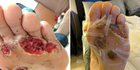 man foot fungus barefoot shower at gym