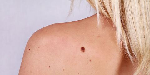 skin cancer causes surprising