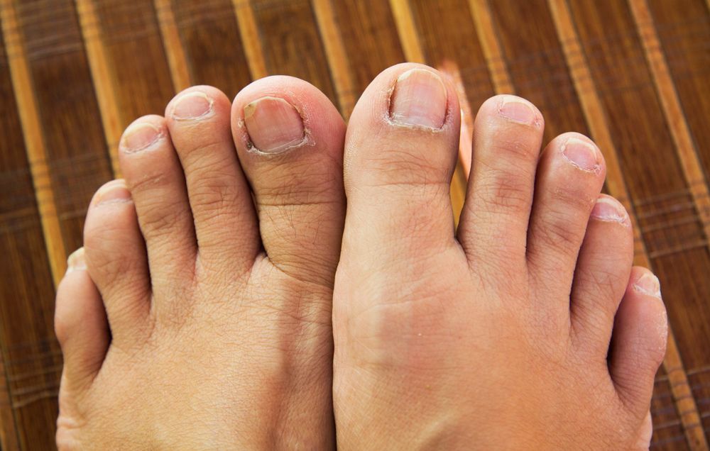 pale moon shape on toenails