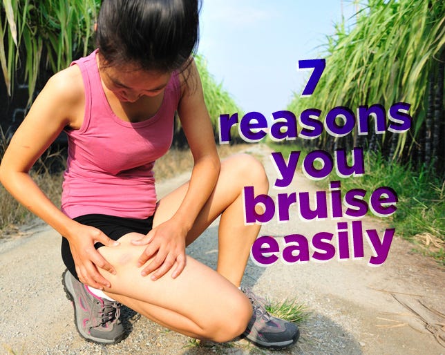 7 Reasons You Bruise Easily
