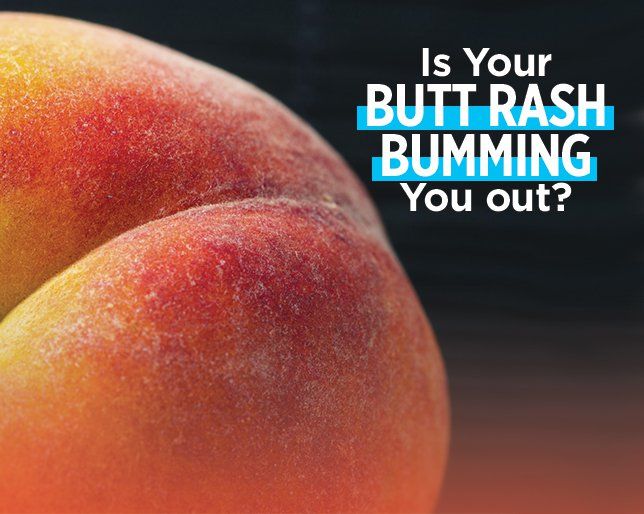6 Reasons Your Butt Is Red And Itchy