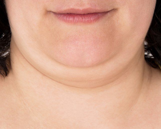 Will taking adderall make me lose weight image 4