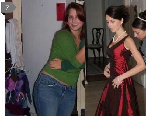 What S Wrong With This Amazing Weight Loss Story Everything