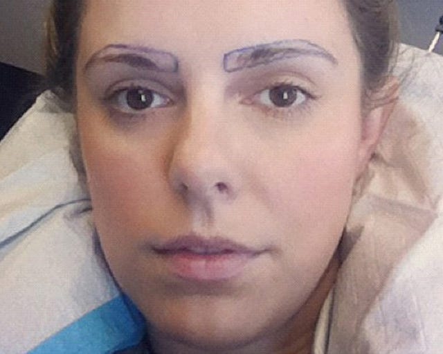 The True And Oddly Fascinating Story Of Eyebrow Transplants