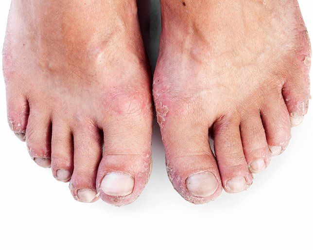 milk with dead skin shavings from her feet