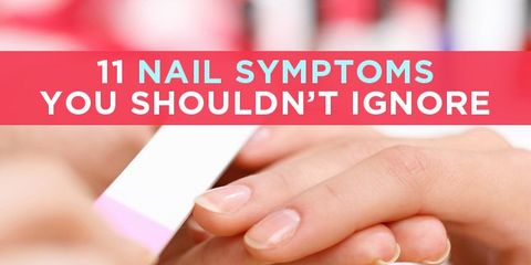 nail-symptoms.jpg