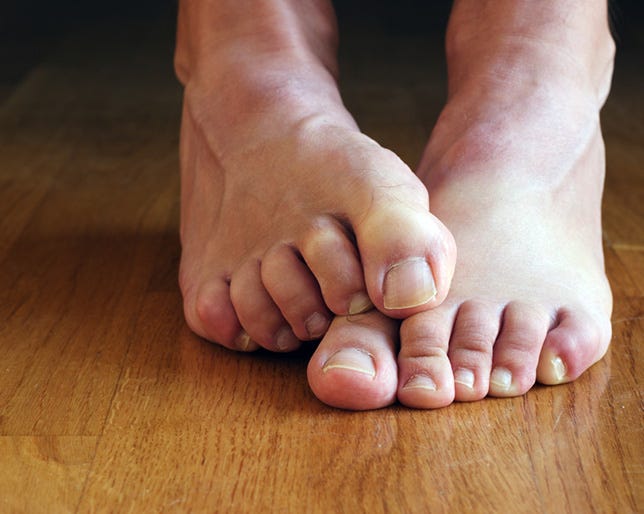 5 Ways To Deal With Stanky Feet