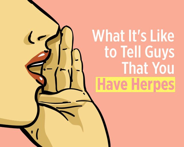 Do guys get herpes