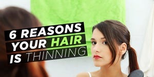 thinning-hair.jpg image