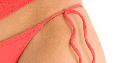How To Avoid DIY Bikini Wax Mistakes