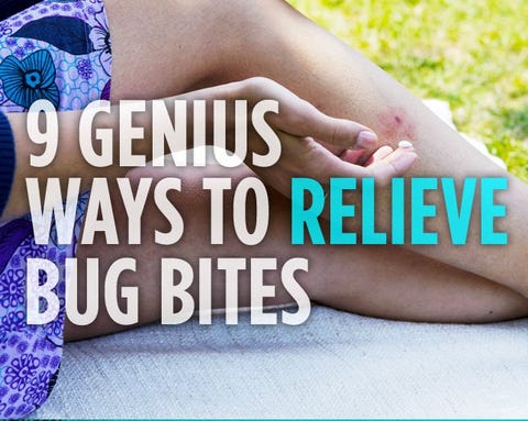 9 Genius Ways To Relieve Bug Bites