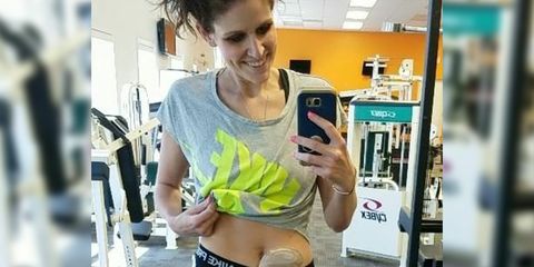 Lindsay Dickerson fitness after ileostomy