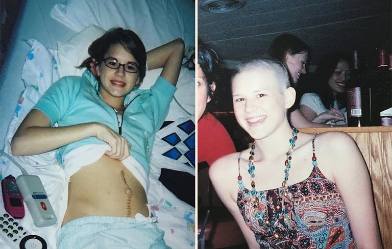 15 kg weight loss before and after photo 9