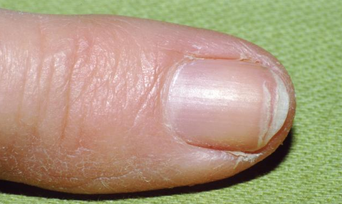 8 Weird Things That Can Happen To Your Fingernails And What They Say About Your Health Women S Health