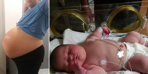 This Mom Gave Birth To A 13 Pound Baby