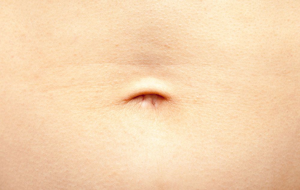 infected tummy tuck belly button