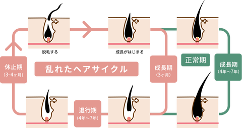 医師監修 産後に抜け毛が増えるのはなぜ いつからいつまで続く 抜け毛の対策５つを解説 ビューティ Elle エル デジタル