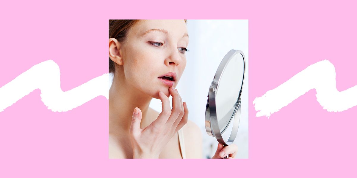 唇ニキビの原因とは 口まわりニキビの対処 予防法 皮膚科医監修